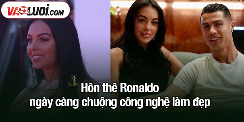 Hôn thê Ronaldo ngày càng chuộng công nghệ làm đẹp