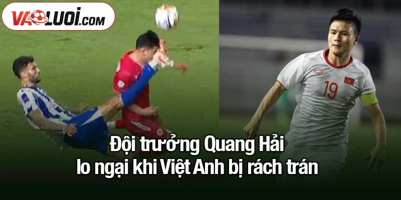 Đội trưởng Quang Hải lo ngại khi Việt Anh bị rách trán Quang Hải lo ngại khi Việt Anh bị rách trán sau va chạm