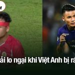 Quang Hải lo ngại khi Việt Anh bị rách trán