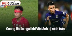 Quang Hải lo ngại khi Việt Anh bị rách trán