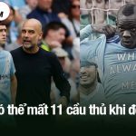 Man City có thể mất 11 cầu thủ khi đối đầu MU